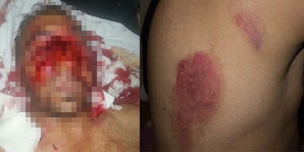 Polis dakikalarca dövüp ateşe attı iddiası!/ Video