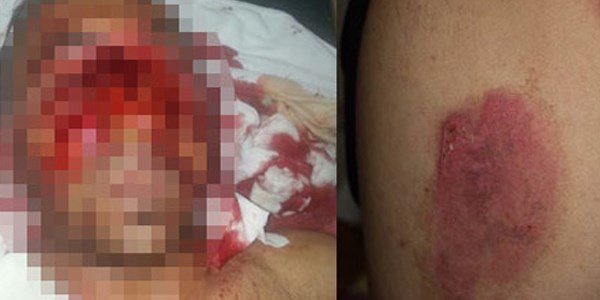 Ate�e atan polislere soru�turma/ Video