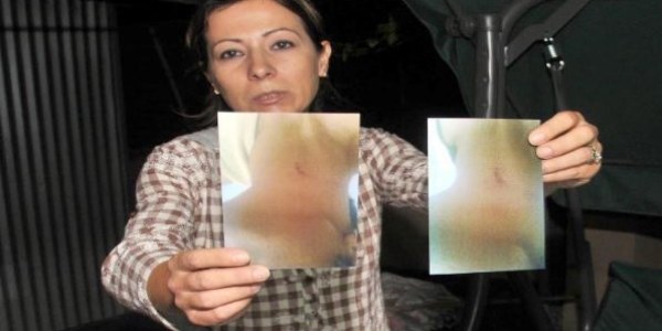 Şiddetin fotoğrafını delil olarak gösterip koruma istedi