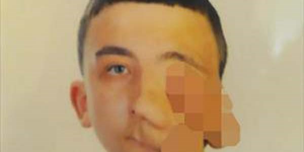 Yüzünde kist oluşan Batıkan'a tedavi umudu