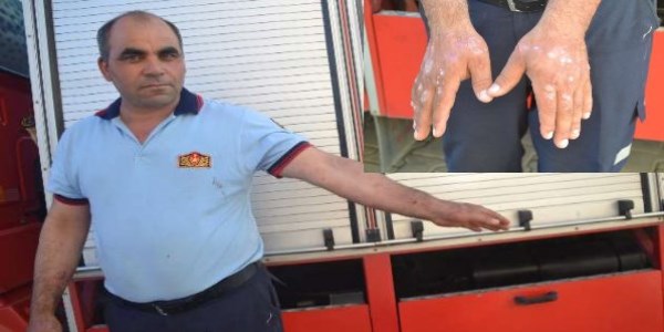Kurtardığı kedi kendisine saldırdı