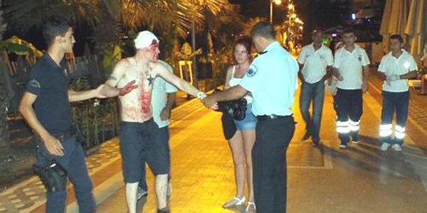 İngiliz turistin başını şişeyle yardılar