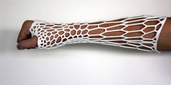 3D yazıcıdan 3 milimetre kalınlığında alçı