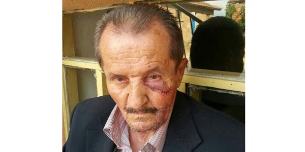 50 TL için yaşlı adama darp