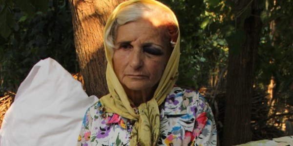 Kapkaççı önce sürükledi ardından darp etti