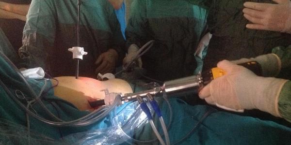 Trk profesrden karacier ameliyatn kolaylatrcak icat