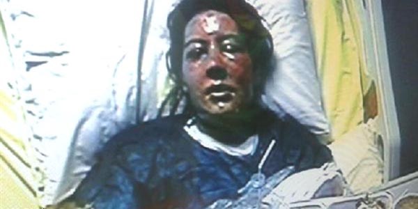 Eşini sıcak suyla haşlayan kocaya müebbet hapis cezası istemi