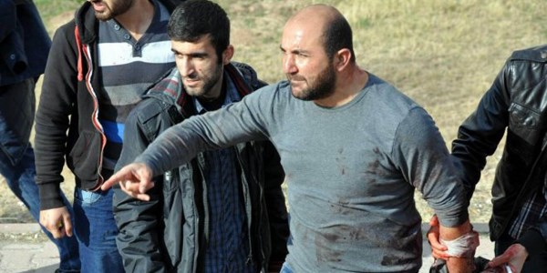 CÜ'de bıçaklı öğrenci kavgası: 4 yaralı