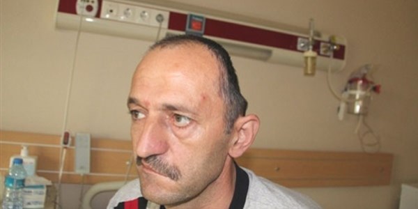 Yapay kafatas� ile hayata d�nd�