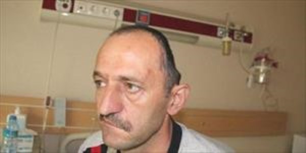 Kafatasına yapay kemik konuldu