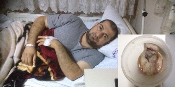 Hastan�n belinde sarg� bezi unutuldu
