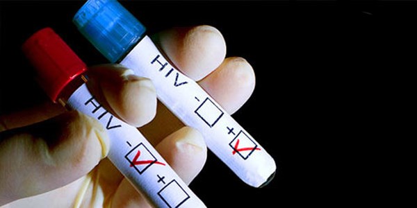 AIDS gençler arasında hızla yayılıyor!