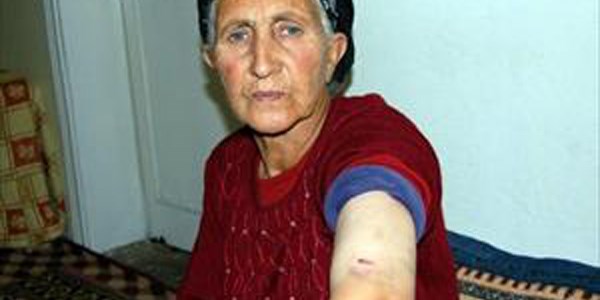 Komşusu tarafından darp edilen yaşlı kadın yaralandı