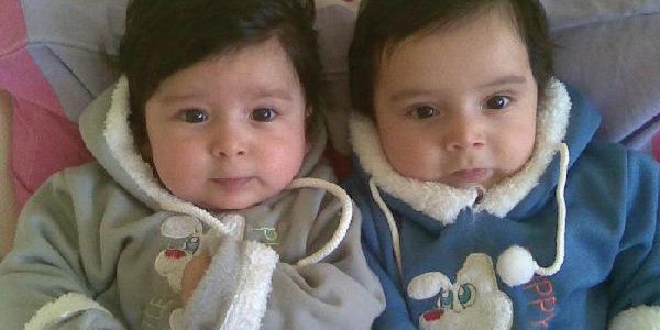 Tek yumurta ikizlerinden minik Yakup yo�un bak�mda