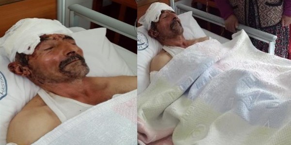 Koyununu ararken köpeklerin saldırısına uğradı