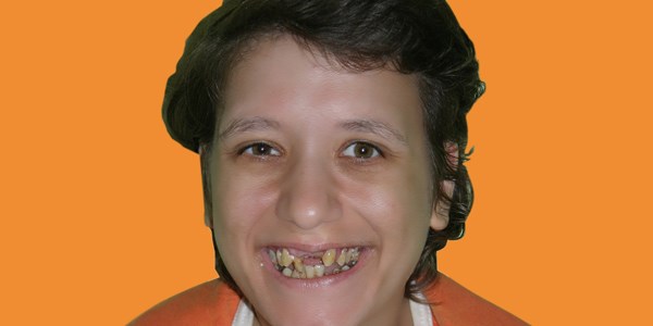 Engelli k�z, misafirli�e gitti�i evde yanarak can verdi