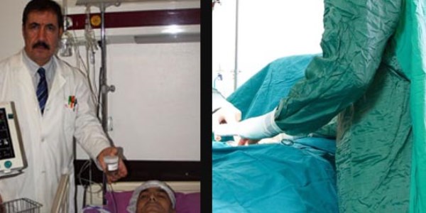Böbreğinden 248 tane taş çıktı
