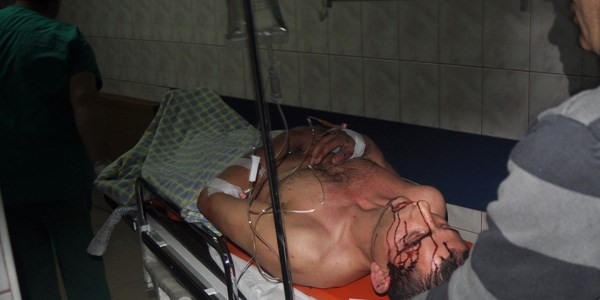 Otel �n�nde silahlar konu�tu