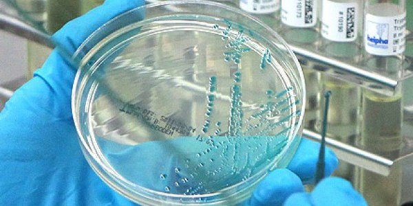 H10N8 kuş gribi virüsü insana bulaştı