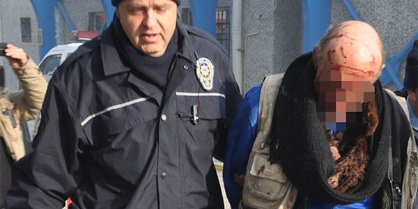 Polislere sopayla saldırdı