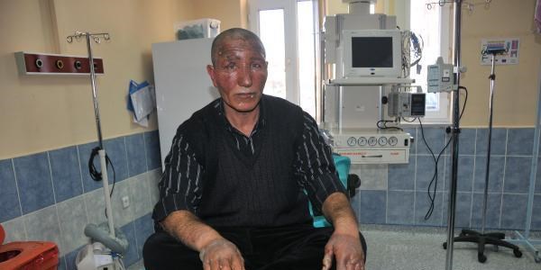 T�pgaz ka�a�� hastanelik etti