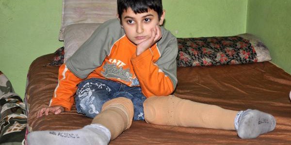 Ayaklarını ot biçme makinesine kaptıran çocuğa protez bacak