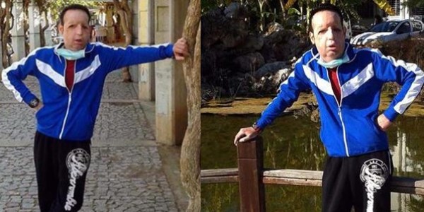 Y�z nakilli Recep Sert, maskesiz bir g�n ge�irdi