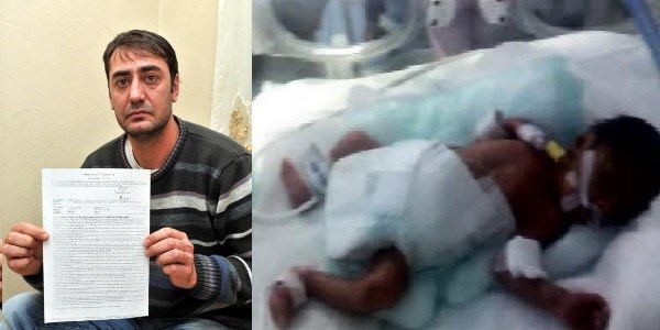 23 g�nl�k �zge bebe�in kangren olan baca�� kesilecek