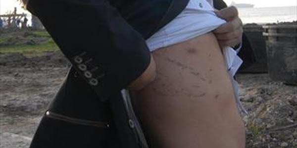 'Düğünde jandarma tekmesiyle akciğerim yırtıldı' iddiası