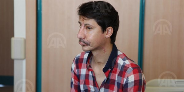 Yüz nakli olan Sert'in ilk görüntüleri paylaşıldı/Video