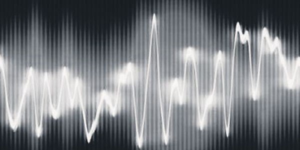 Erdo�an sesinin telif haklar�n� al�yor