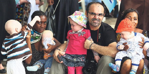 T�rkiye Albino'da k�y kuruyor