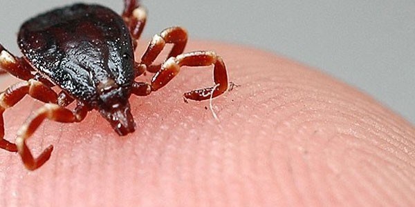 Kene vücuttan nası çıkarılır?