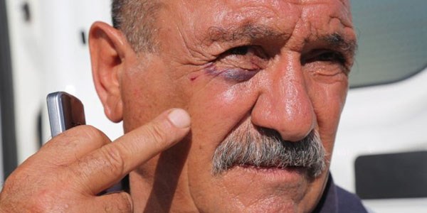 Ambulans şoförüne çirkin saldırı