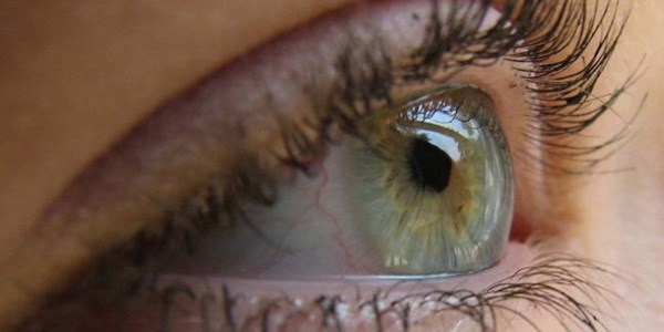 G�z tansiyonu k�rl��e neden oluyor