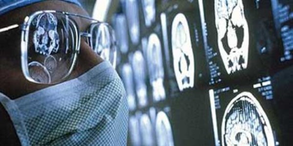 Sigara akci�er kanserini y�zde 300 oran�nda artt�rd�