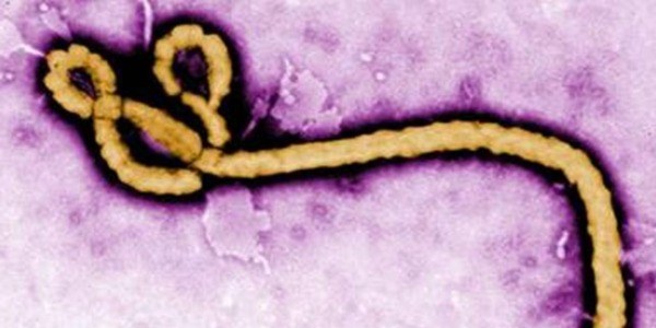 Sağlık çalışanlarına ebola virüsü uyarısı