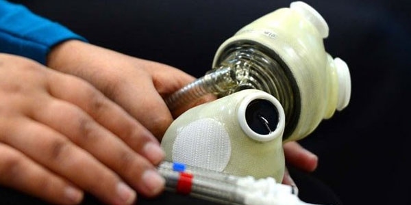 Türkiye yapay kalpte dünya üçüncüsü