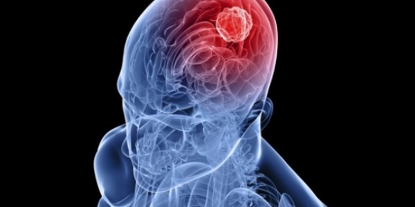 Vardiya beyni �abuk ya�land�r�yor