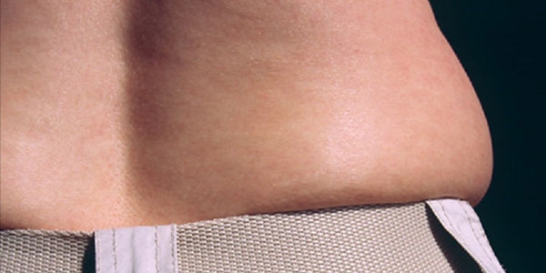 Fazla kar�n ya�lar� bel a�r�tabiliyor!