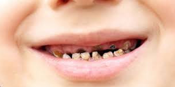 rk diler bbrekleri vuruyor