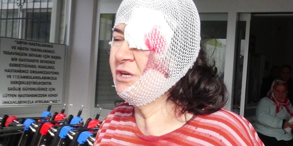 Eşi ve öğretmen kaynı tarafından dövüldü iddiası