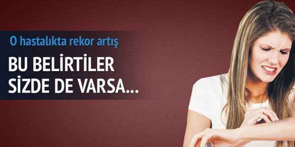 Sedef hastalığında rekor artış