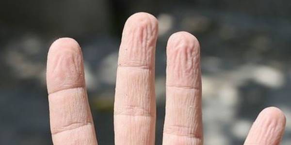 Parmakların suda buruşmasının gerçek nedeni