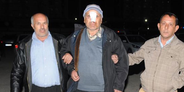 5 hastane dolaştı ama burnundaki yaraya dikiş attıramadı