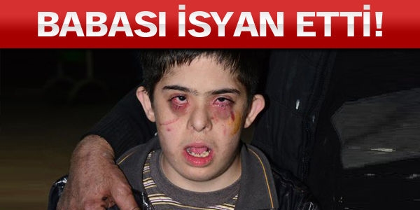 Down sendromlu Şakir bu hale nasıl geldi?
