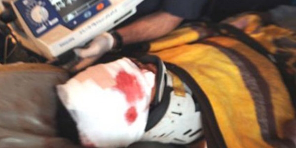 Yerde buldu�u cismin patlamas� sonucu yaraland�