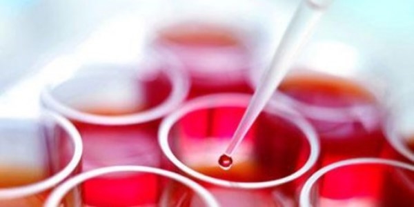 Kök hücre araştırma laboratuarlarında sona gelindi