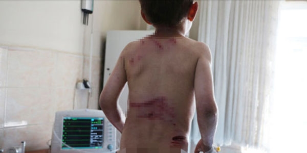 5 ya��ndaki Ey�p k�peklerin sald�r�s�na u�rad�