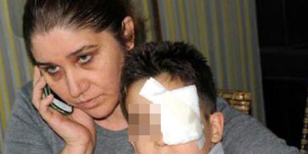 Kitapla öğrencisini yaralayan öğretmene dava